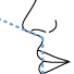 rhinoplastie - Courube de Sheen
