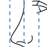 rhinoplastie - Oeil